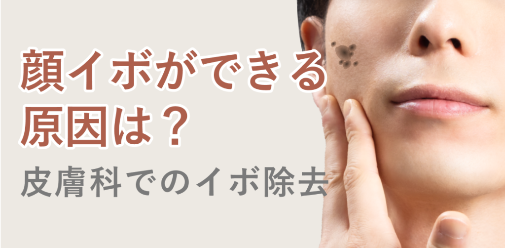 毛穴の黒ずみ 黒ずみ毛穴 の改善方法とは？原因・ケア対策・治し方を知ろう！美容皮膚科タカミクリニック 東京 表参道