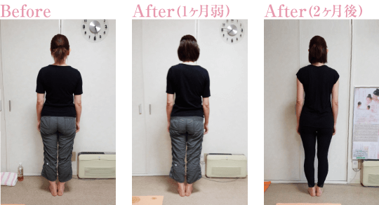 ビフォーアフター 2週間で「-11cm」のダイエット成功！！ 30代女性- パーソナルダイエットジムSWITCHBODY福山店・岡山店