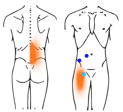 内臓の動きを活性化し、足腰まわりも軽くなる。腰痛のトリガーポイントって何？ 崎田ミナのつかれにピンポイント！くらしクロワッサン オンライン