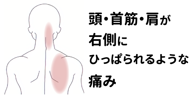 間違いない イケメンは「首を痛めている」と言える７枚の証拠 画像COROBUZZ