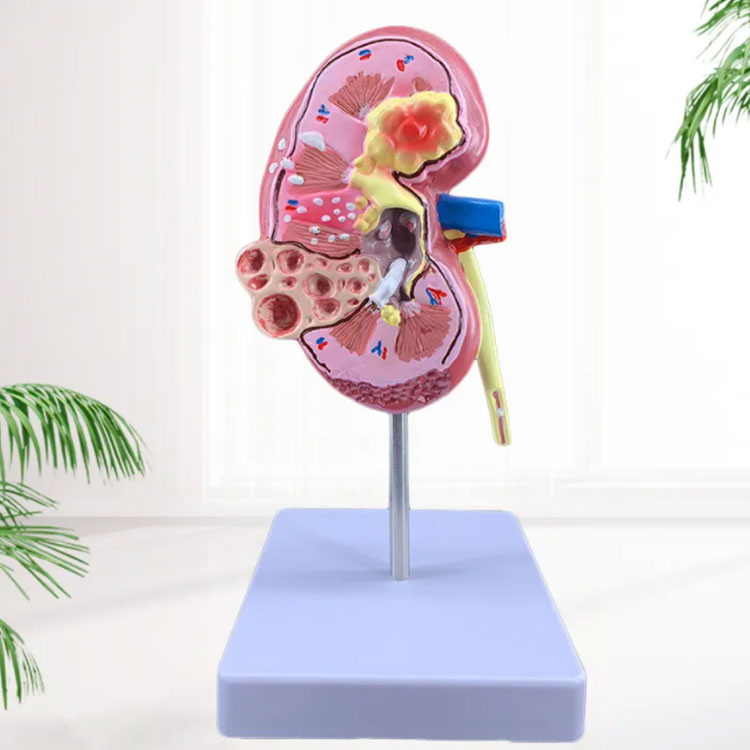 腎臓の位置と断面図のイラスト - 医療のイラスト・写真・動画、素材販売サイトのメディック medick