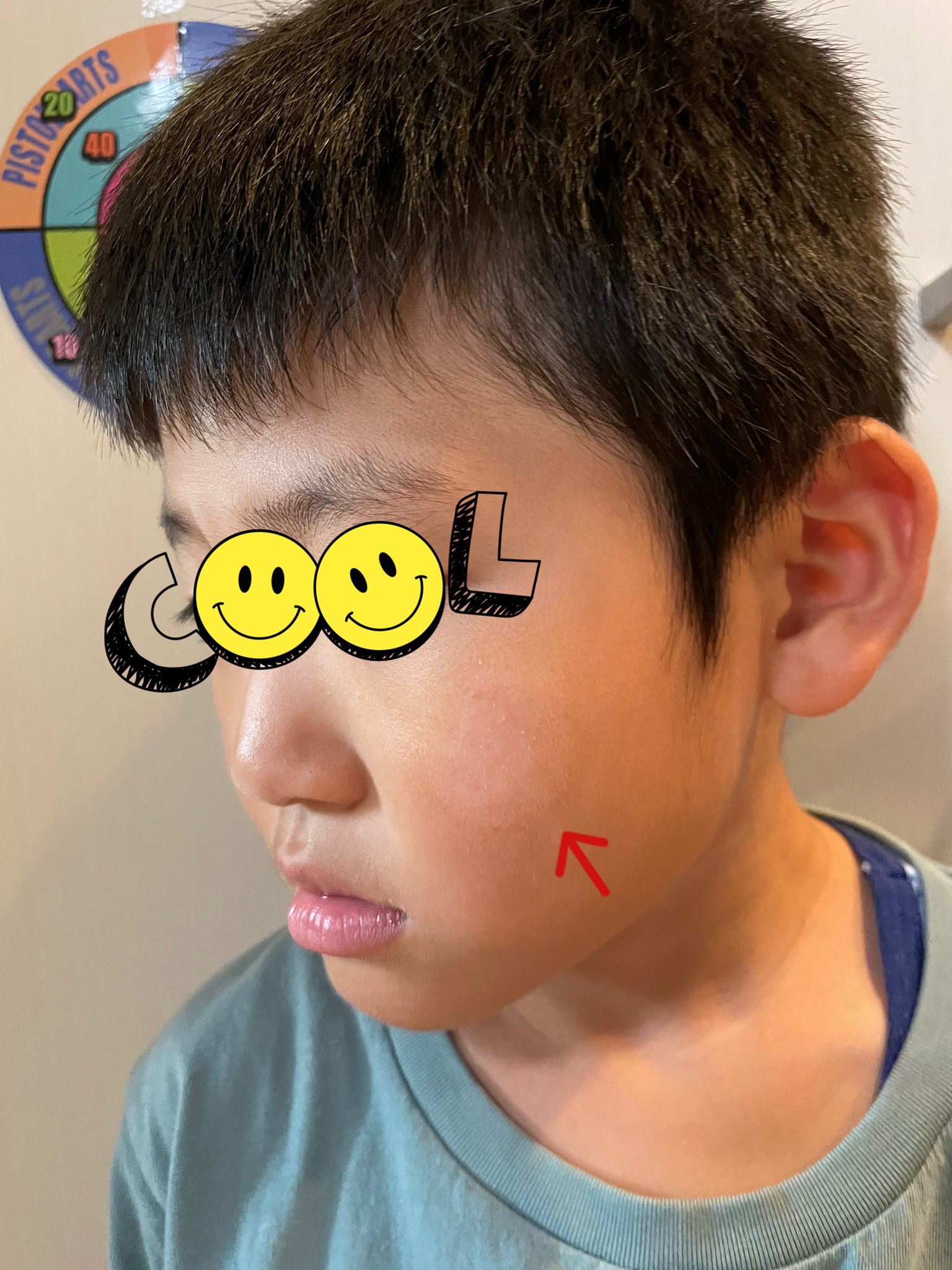 その他の湿疹・皮膚炎の疫学・病態マルホ 医療関係者向けサイト