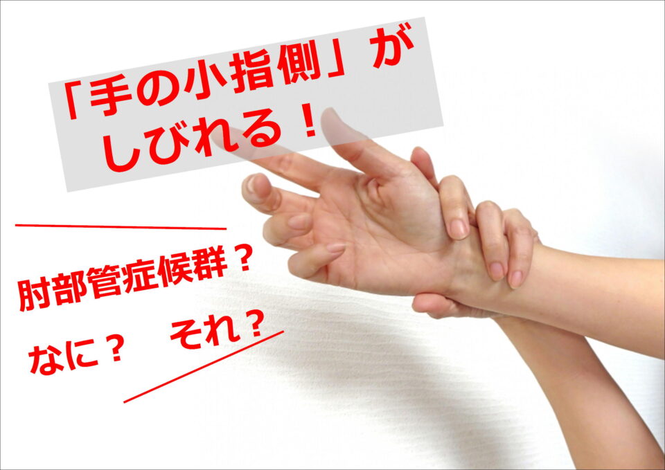 指のしびれで困っていませんか？～手根管症候群はどんな病気？～よこやま整形外科 手とリウマチクリニック