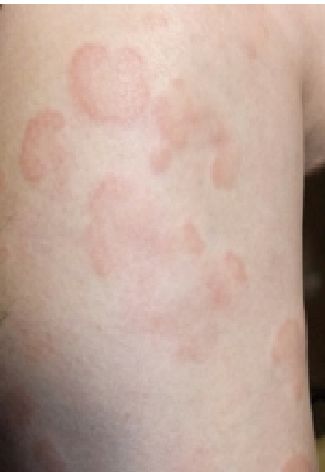 日本臨床皮膚科医会-ひふの病気