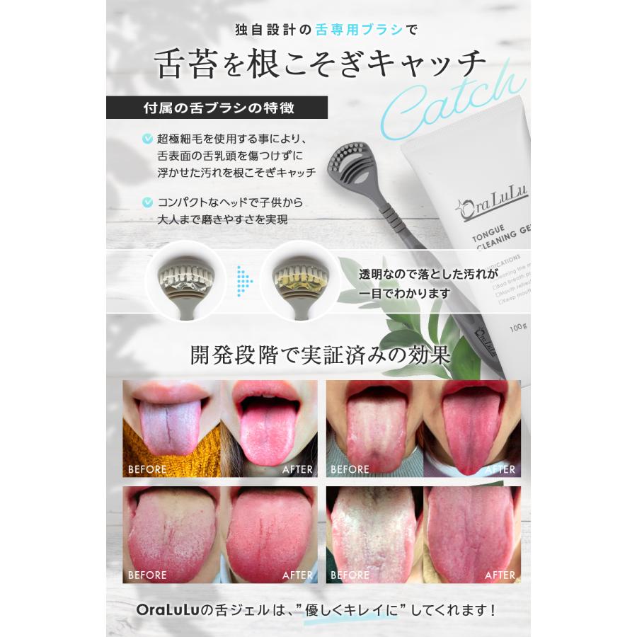 舌苔 ぜったい目黒の歯医者・歯科目黒石本歯科クリニックー幅広い治療に対応し患者様一人一人に合った治療計画を提案し丁寧な治療を心掛けております