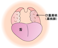 扁桃腺と子どものいびき：手術の対策は必要なのか？阪野クリニック
