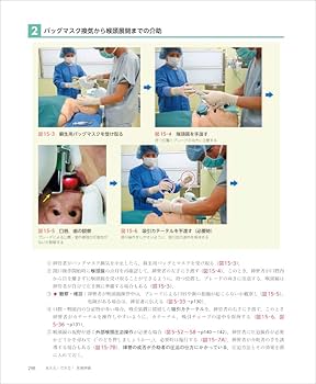 気管挿管 3ページ目 ：Cadetto.jp