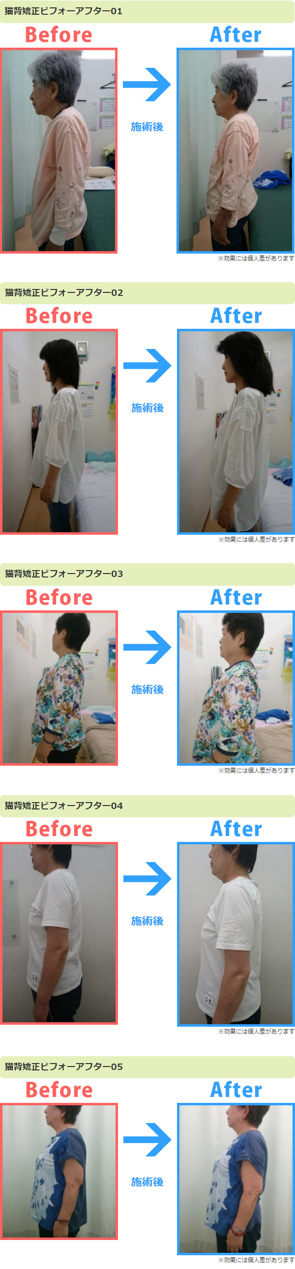 心理的ストレスによる悪い姿勢姿勢インフォメーション