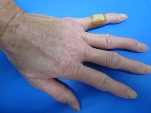 キュレル・Shizuka BY SHIZUKA NEWYORK・innisfree・オルビス・ラッシュのスキンケア・基礎化粧品を使った口コミ -今回は私が約半年で毛孔性苔癬にかなり効 by ンゴ🐣 乾燥肌 20代後半LIPS