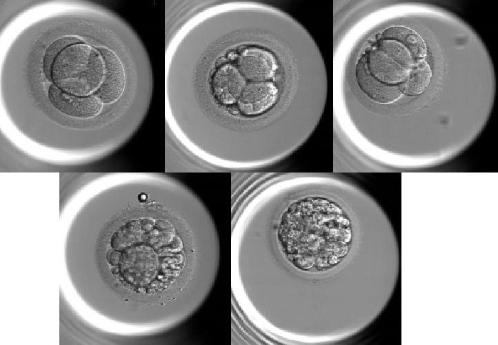 受精卵〜胚盤胞の成長過程のイラストのイラスト素材73917833- PIXTA