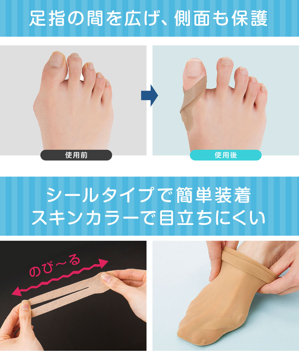 ケガの予防、補強に。お母さんでも巻けるテーピング実践術 動画付きサカイク