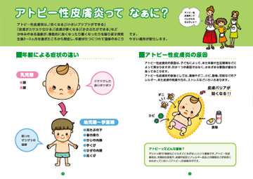 いま、アトピー性皮膚炎治療の現場が熱い！：日経メディカル