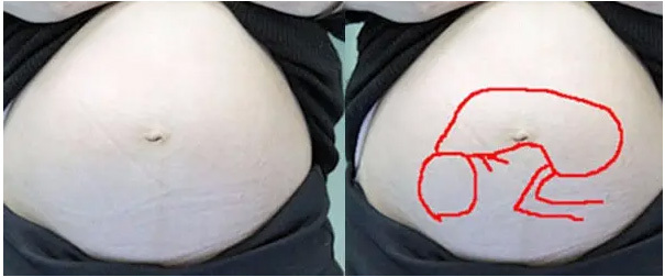 32w5d 赤ちゃんの向きとわたしの寝る姿勢についてもふ&るん 年子姉妹 子育て日記