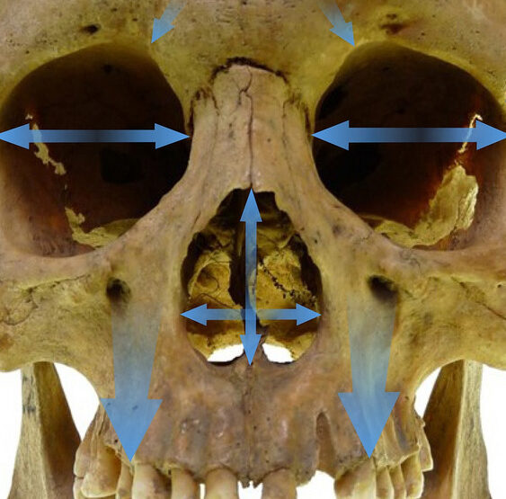 波動・バランス整体 ウェイブ 『痛みのチェック 頭蓋骨の痛み』