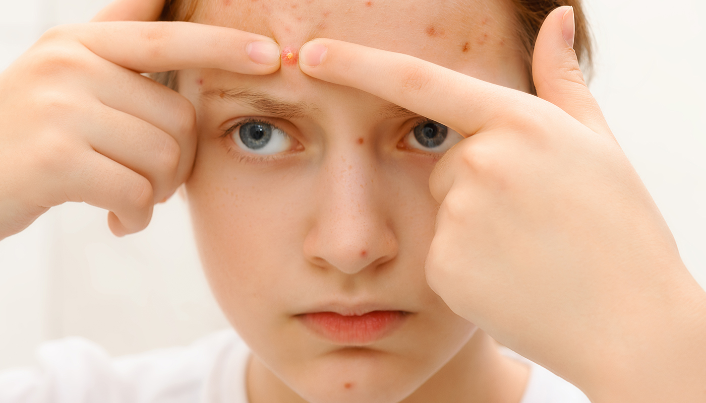 薬剤師が解説 首にできものがある原因は？使える市販薬8選 – EPARKくすりの窓口コラムヘルスケア情報