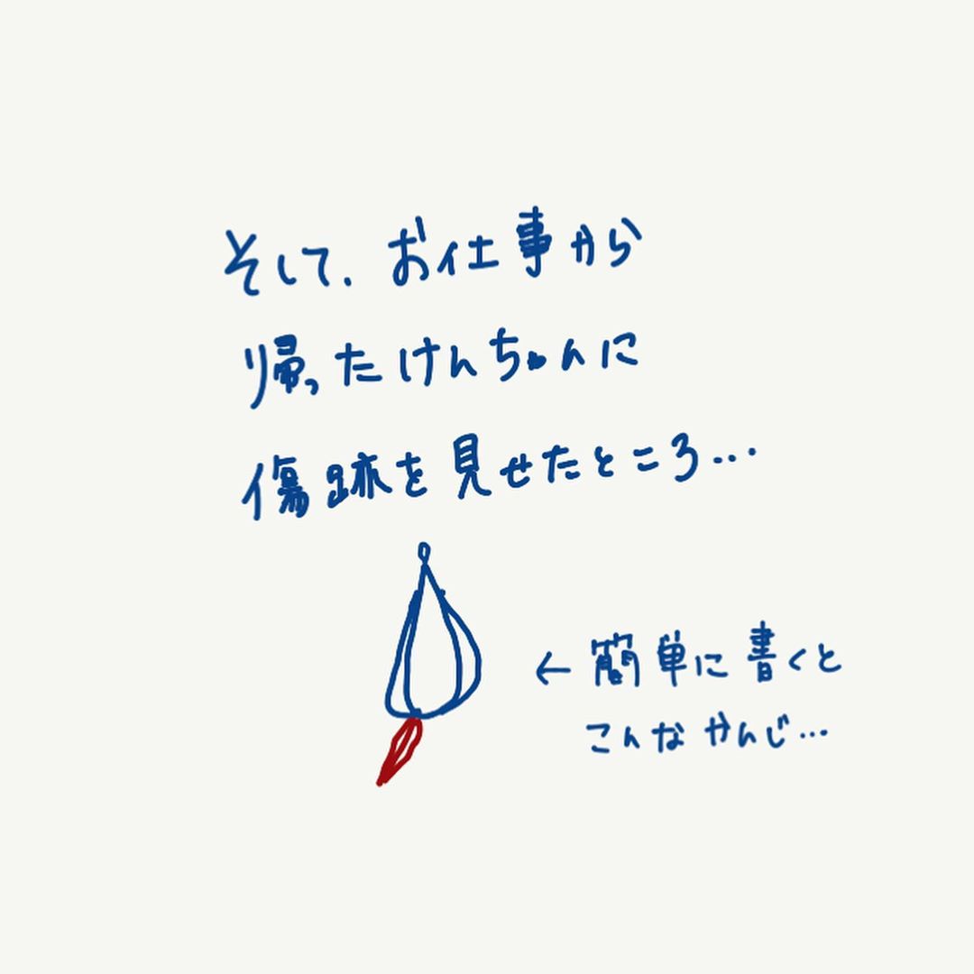 会陰部贅皮切除術 最安値180,000円 安い！上手い！ 東京 銀座 渋谷 新宿 横浜 千葉 さいたまボンボンクリニック 銀座駅前本院・渋谷院