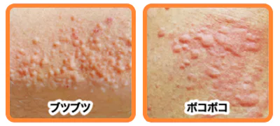 有名精油を、和精油に置き換えると 海外の有名精油は 日本の植物でも代用できます もっと身近で、もっと地域に根ざした選択をすると、 ①ラベンダー →スギ ・ラベンダーの「安らぎ」「緊張緩和」は、スギの木の香りで得られます ・森林浴効果で副交感神経を刺激し、深い