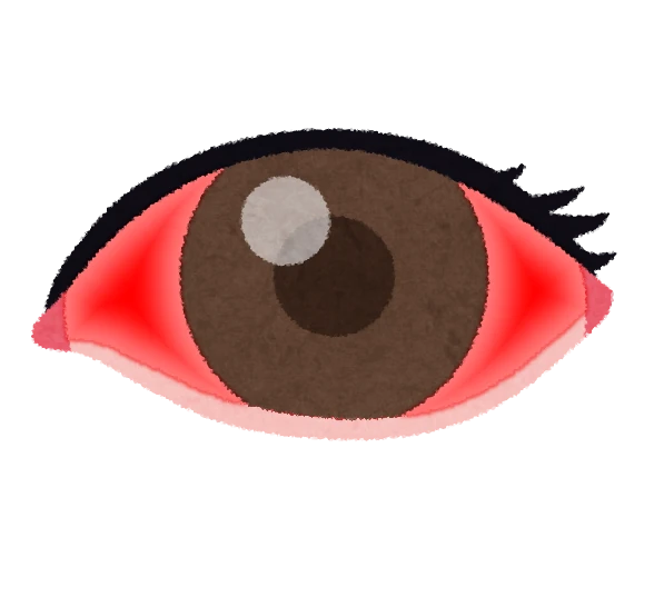 眼の充血の原因は？考えらえる結膜の病気・対処法を解説 - 眼科DOC-眼科のおすすめ名医を中心に掲載