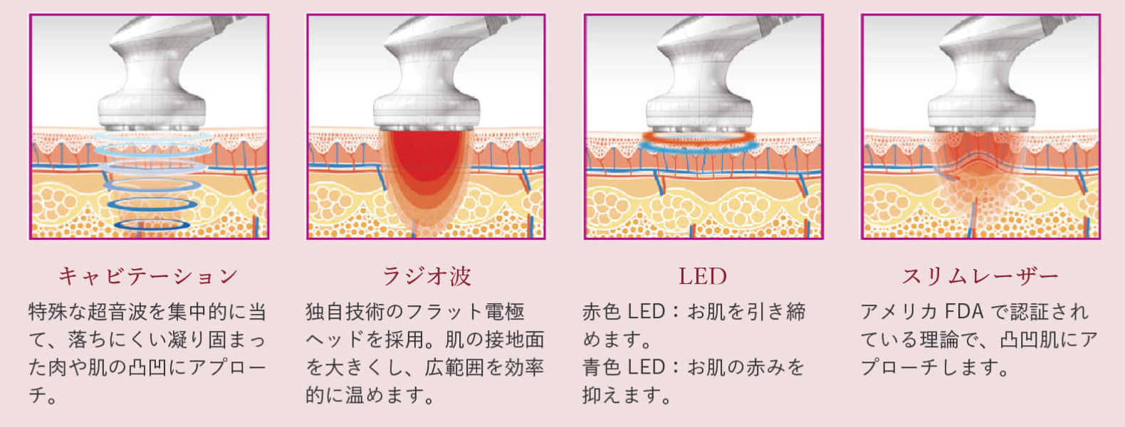 セルライト吸引マシーン痩身エステサロン Shanti シャンティ 結果重視のダイエットエステ