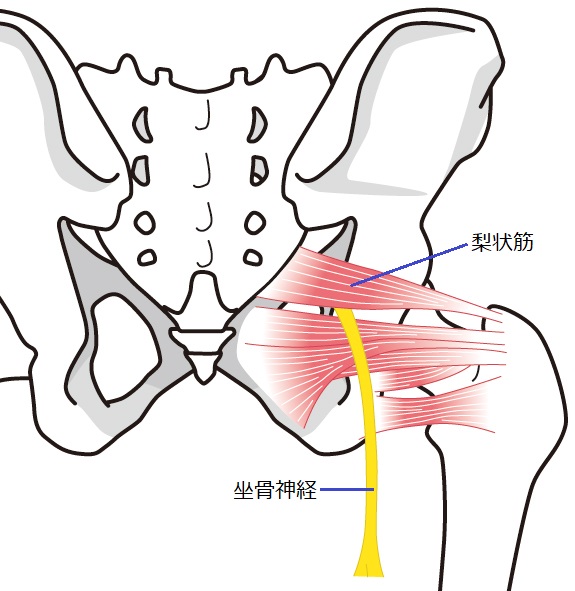 お尻が痛い！！京成曳舟駅前プラザ接骨院