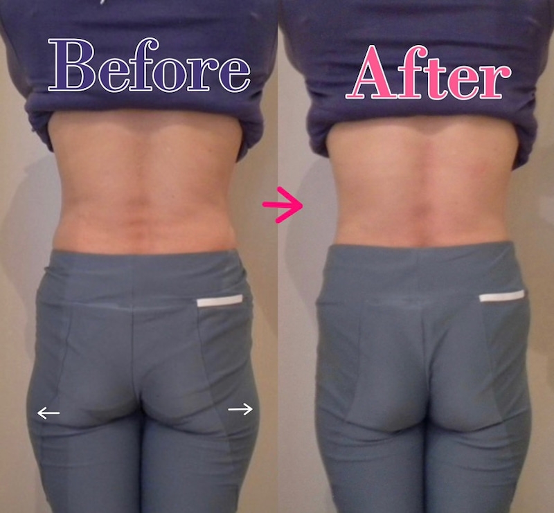 骨盤矯正 横浜 中区の整体「よこはま山手治療院」