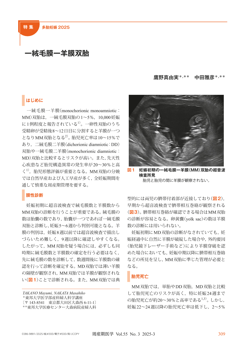 超重要！“膜性診断 まくせいしんだん ”て何？多胎マム