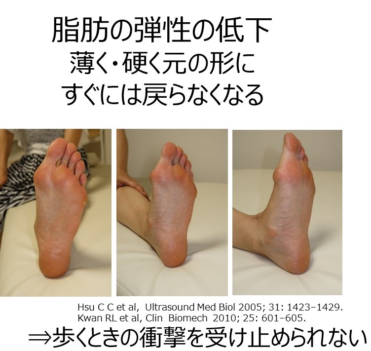 足の皮のめくれの原因は・大阪玉造 ドイツ式フットケア 魚の目、巻き爪の悩みに