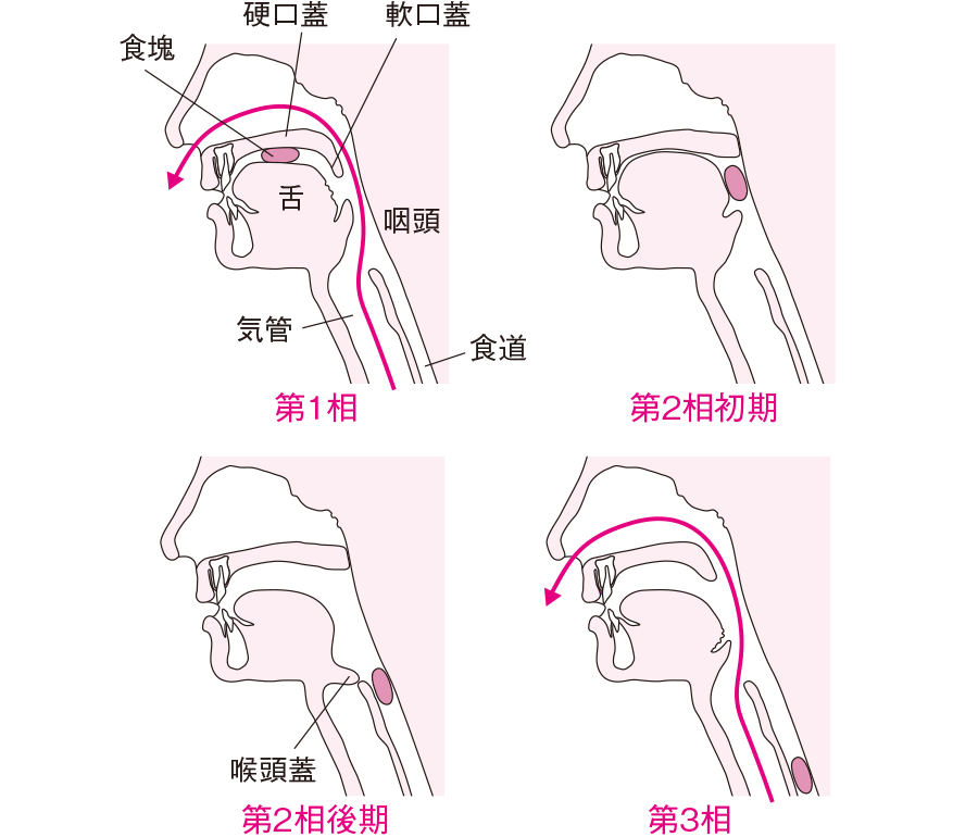 座位や背中を倒した食事姿勢で食べられない方でも、食べられる。 - 誤嚥しないで人生最後まで口から食べられる完全側臥位法