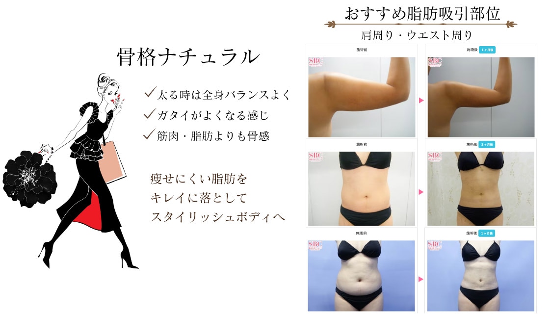 骨格ウェーブの太る原因は？2024 年のリアルなLemon8ユーザー体験