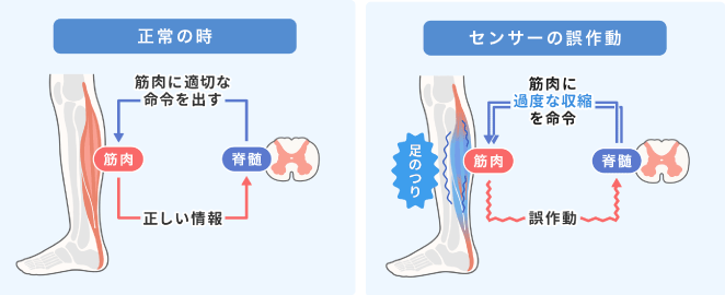 こむら返りの原因と予防法、簡単ストレッチで秒で治す！トレーニングあいメディアあい鍼灸院・接骨院