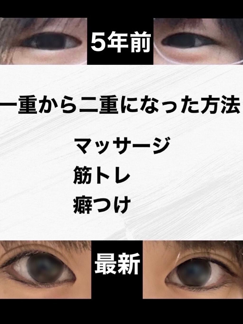 上が普段の目､下が見開いた目です｡目を上手く見開くことができません。見開くとき- Yahoo!知恵袋