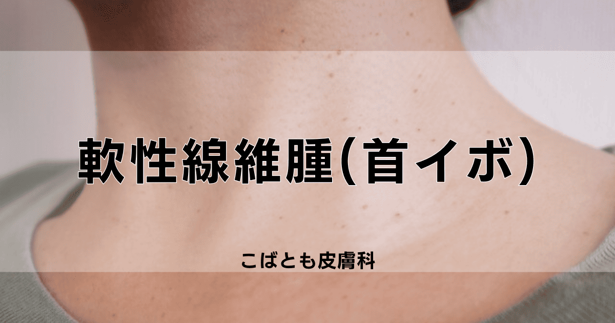 首イボのできる原因は？皮膚科で取る3つの除去方法 - 東京・大阪の美容皮膚科ならFLALU フラルクリニック