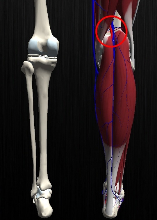 膝のしこりの原因は？何科に相談すべき？医師が考える正しい受診先ひざ痛チャンネル