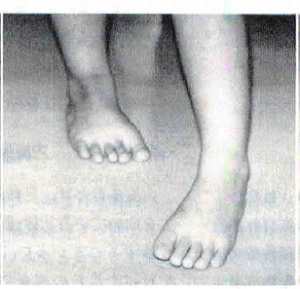 歩くときにつま先立ちしているような 」 発達障がいをお持ちのお子様には、感覚過敏や空間認知がうまくいかないという理由で独特な歩き方をするお子様もいらっしゃいます👣お家での遊びを通して、正しい筋肉の使い方、バランスの取れた歩き方が身につくよう サポートして