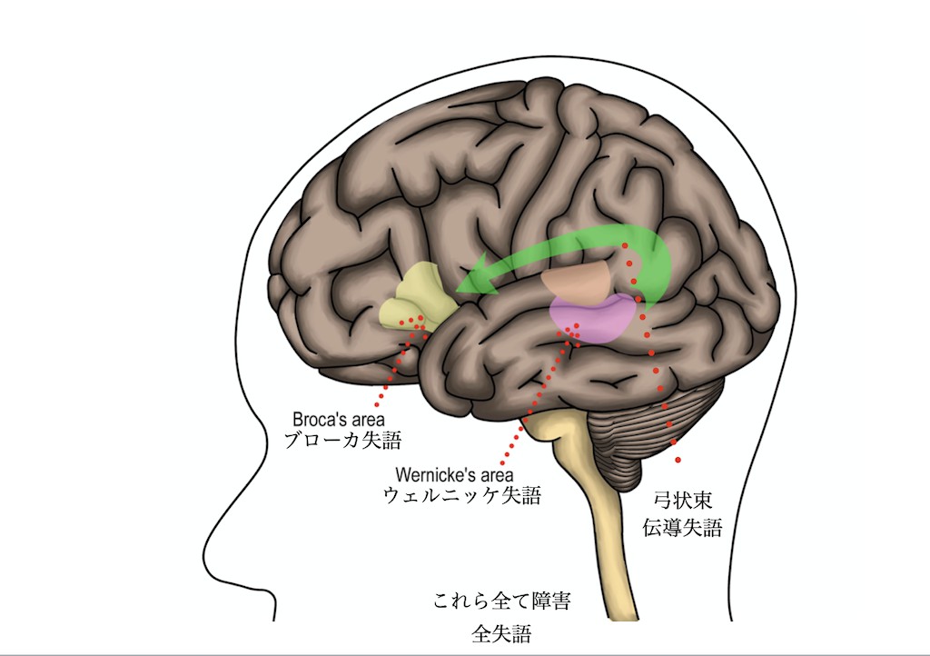 弓状束についてくろ 作業療法士