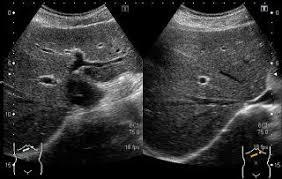 胃カメラでわかる病気内視鏡・堺 ましも内科・眼科クリニック 胃カメラ・大腸カメラ