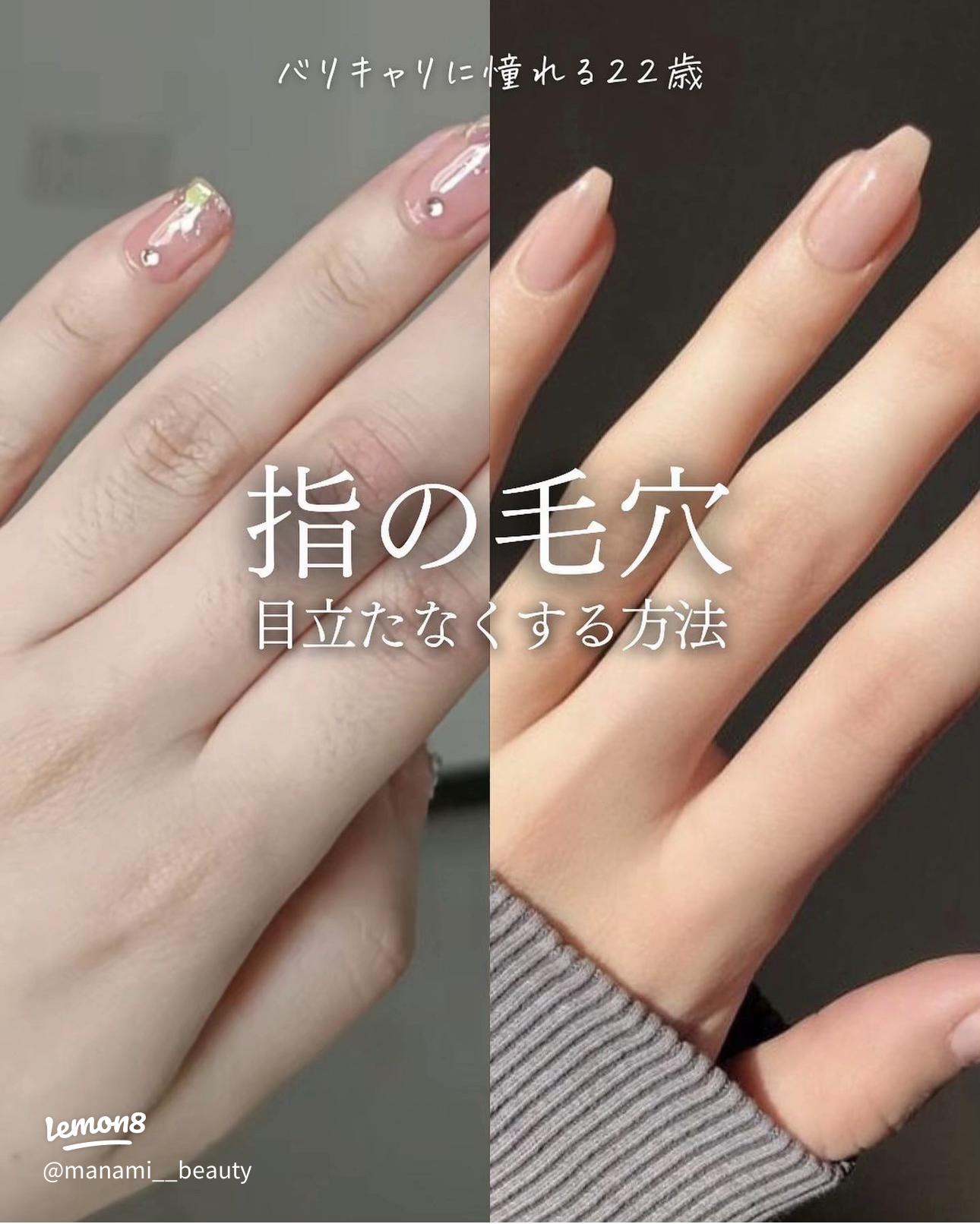 手の甲や指毛 濃い男性の場合はレーザー脱毛施術一択！ダビデクリニック新宿