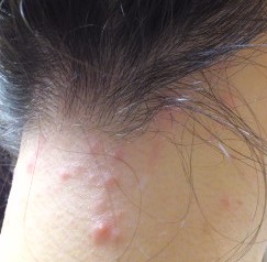 頭が痛いときに考えられる原因は？頭痛の種類と症状を和らげる方法健康サイト