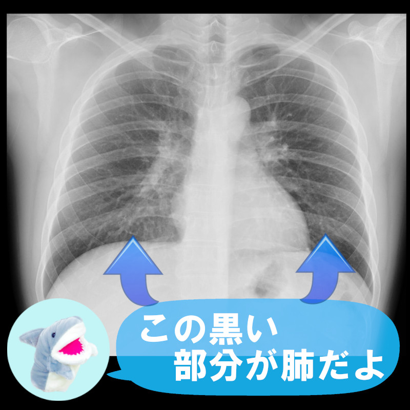 医療コラム レントゲン検査～長尺撮影とは～ – 函館五稜郭病院