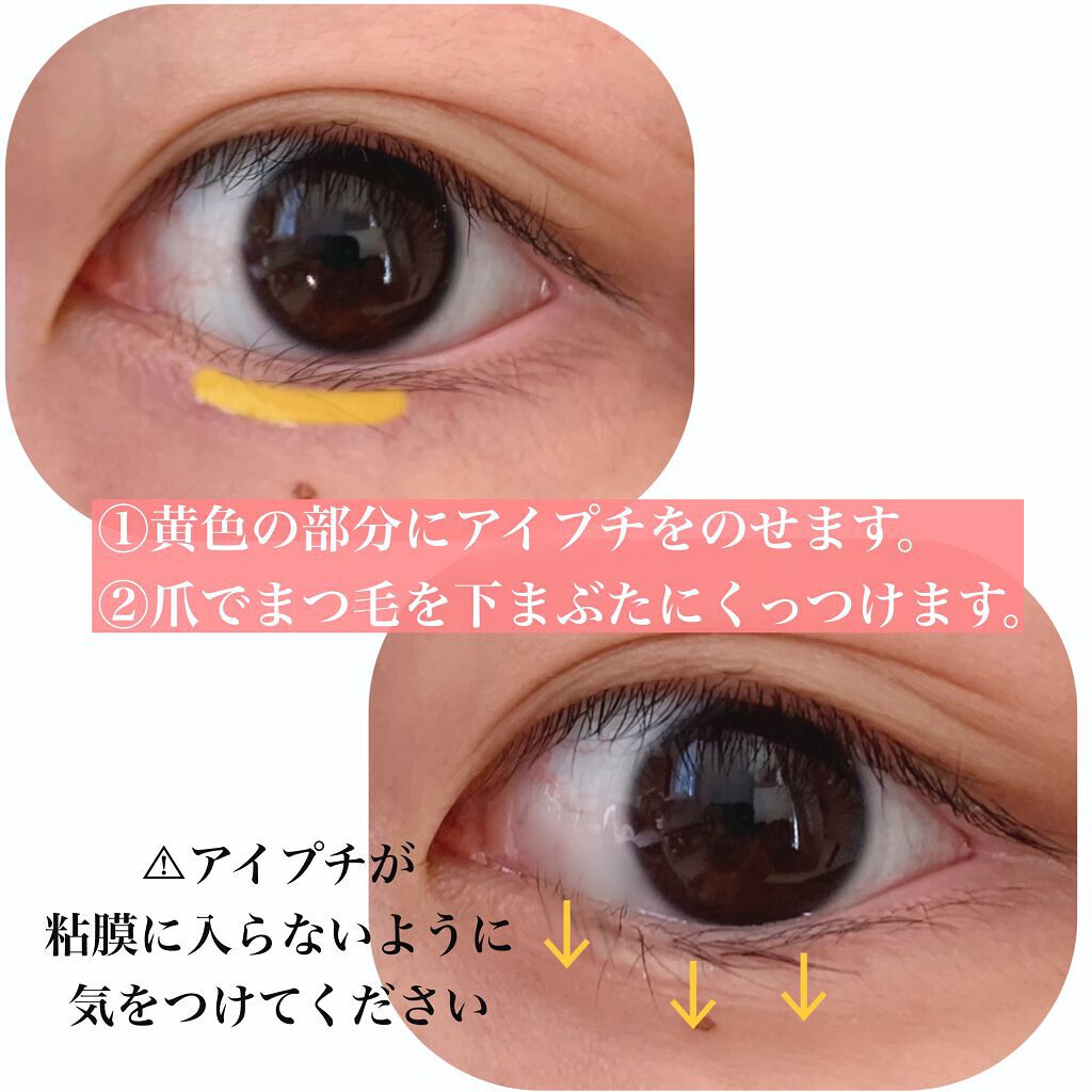 一重たるみまぶた用アイラッシュカーラー 一重用 奥二重 たるみまぶた 短いまつげ まつ毛 アイメイク コスメ 根元からキャッチ 目力UP 山型 日本製: 通販奉行 - 通販 - Yahoo!ショッピング