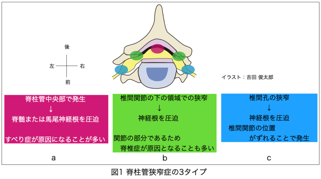 看護学生のための病態関連図の書き方 看護学生 関連図の書き方～