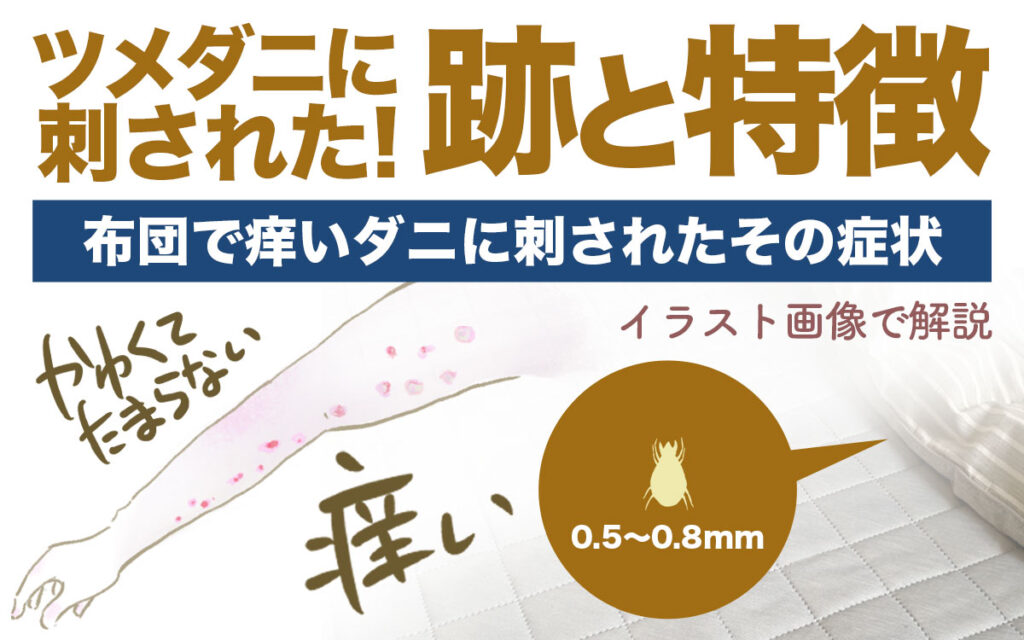 やあ、みんな、これなんだかわかる人いる？噛まれた跡が何かわからなくて。ここが正しいサブなのかわからないけど、フィンランドで起きた ことだから、もしかしたら知ってる人がいるかなって。ダニじゃないかちょっと心配。背の高い草の中を歩いたんだ。 : r Finland