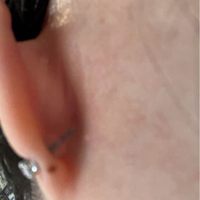 ほくろ占い 「耳」「首」のほくろが示す意味＆運勢 ページ1000みのり当たる無料占い＆恋愛占い