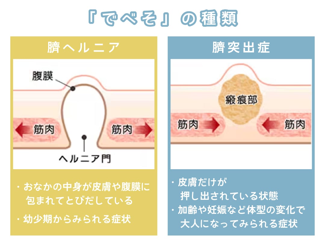 当院では臍ヘルニアの圧迫療法を行っています。 – 医療法人むかわクリニック – 小児科・内科 – 福島県郡山市