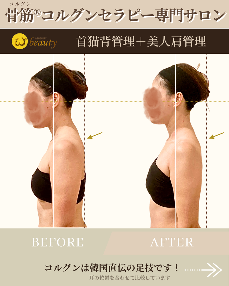 猫背矯正 - クリニカル・ラボ Twinray 整体院