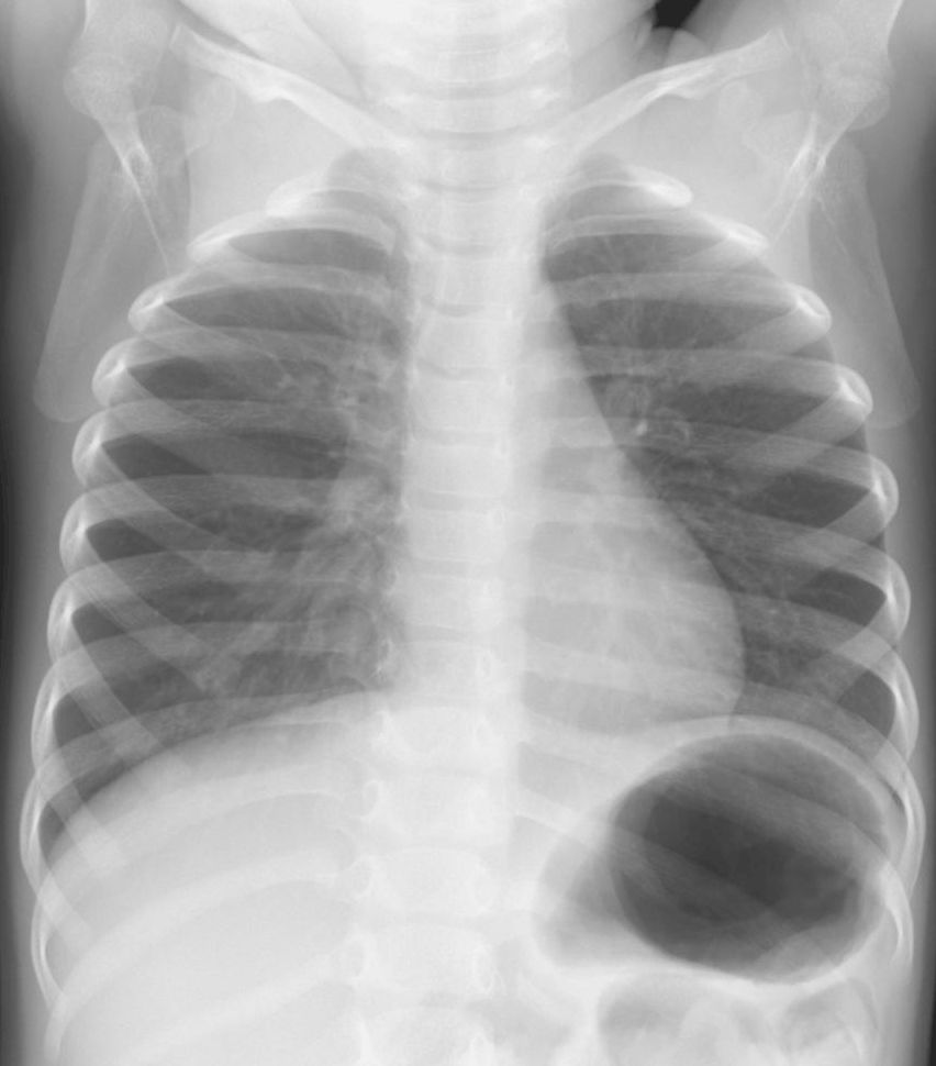 骨盤 仙腸関節 の治療診療メニューいでの整形外科リウマチ科クリニック
