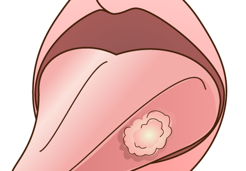 イラスト解説 肥大・過形成・化生・再生・創傷治癒・萎縮・変性・壊死・アポトーシスどっと. New life