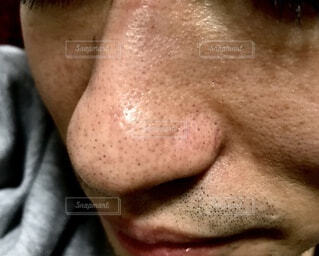 撮影おわり🌼📸 めばちこが出来て朝から眼科に行ったり バタバタな今日でした🥺❗️ ものもらい？めばちこ？笑😂そして、前髪切りたい衝動にかられている ❗️ ❤️おしらせ❤️ 8月23日 日 16:00〜17:00 積水ハウスさんのZOOMオンライントークイベントに出演します