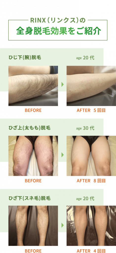 男性ホルモンが多い女性の 顔つき～特徴と減らす方法～大阪府豊中市の不妊鍼灸なら、ぽん鍼灸院