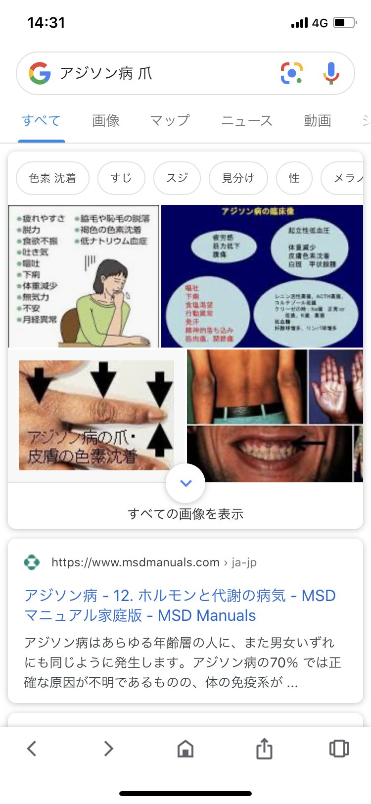 顔の色素沈着過多または茶色の斑点, これらの5つの要因によって引き起こさ